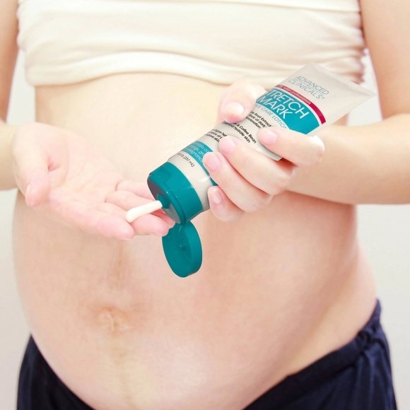 ADVANCED CLINICALS Stretch Mark INTENSIVE CARE LOTION 237 ml - 8fl.oz - Picture 4 of 4